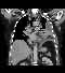 Miniatura de serie