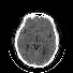 Miniatura de serie