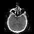 Miniatura de serie